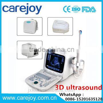 3D Full Digital Portable Ultrasound Scanner with PC platform