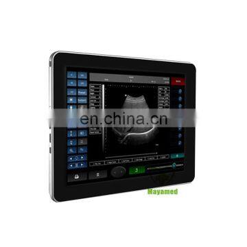 MY-A011 promotion product!compact and portable touch screen diagnostic system ultrasound scanner