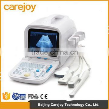 New!!! Full Digital Portable Ultrasound Scanner (PC) with low price