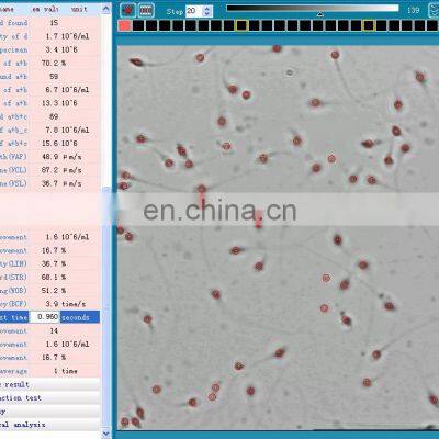High Accuracy Sperm Counting Computer Assisted Sperm Quality Analyzer Sperm Analyzer Trolley photo-5