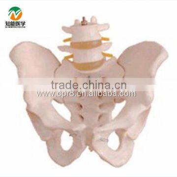 BIX-A1027 life-size pelvis model with 2 lumbar vertebra model