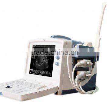 Ultrasonic Diagnostic Equipment HS--3000D2