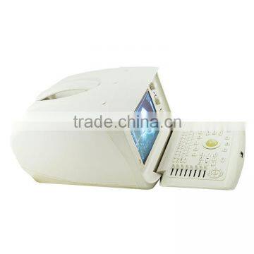 1 USB Factory Price OEM Design 80 Elements R60 Ultrasound Scanner for Pregnancy photo-2
