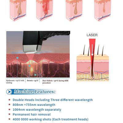 Industrial Standard 755nm Laser Hair Removal Equipment for Salons photo-4