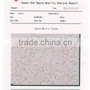 Cheapest Price Sperm Analysis Machine With New Design photo-6