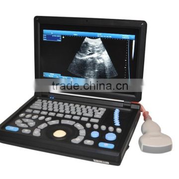 CE approved Laptop PC Ultrasound Scanner /Ultrasonic scanner with 3.5Mhz multi-frequency convex probe RUS-9000E2