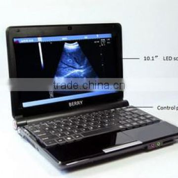 Berry Laptop Portable Ultrasound machine With Two Connectors For Sale