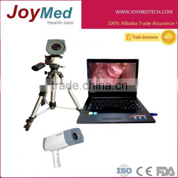 Electronic Colposcope digital with CCD Sony Camera 8,000,000 pixels with PC software