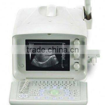 high quality ultrasound scanner for hot sale