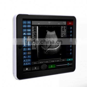 high quality Ultrasound machine for hot sale