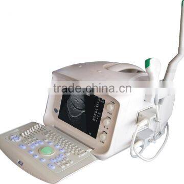 2015 Hot Selling Veterinary Digital Ultrasound Scanner