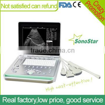 Sonostar 3D Built-in Battery Portable Vascular Cheapest Ultrasound Machine