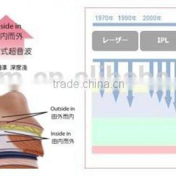 Advanced HIFU Body Slimming for Cellulite Reduction /hifu Double photo-5