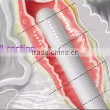 Vaginal Tightening Device Ultrasonic Focusing Technique With Hifu Vagina Treatment photo-4