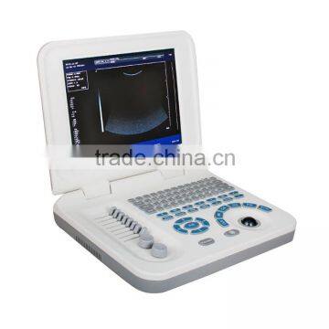 Hot Sale Sony Printer /medical Use Ultrasonic Diagnostic-Large Screen 10.4 Inch Laptop Ultrasound Scanner photo-3