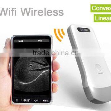 Wireless ultrasound UProbe-2 UProbe-3