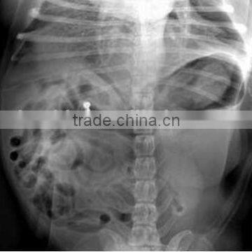 medical x-ray film agfa alibaba in spain, fuji medical x-ray film