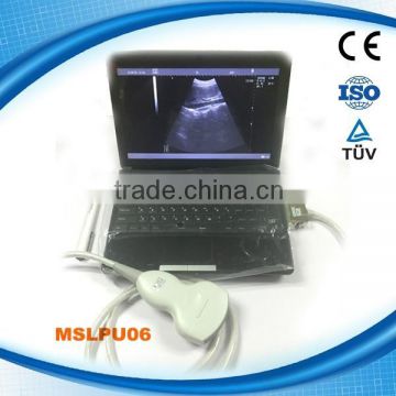 portable digital ultrasound machine, ultasound scanner, ultrasounic manchine MSLPU06W