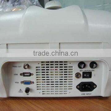 10 Inch Portable Veterinary Ultrasound Scanner for Vet With 3.5MHz Convex Probe RUS-6000V Animal Use photo-2