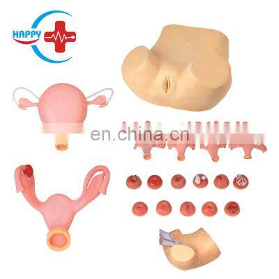 HC-S305 Advanced anatomy uterus ovary model/Medical pelvic cavity gynecology model