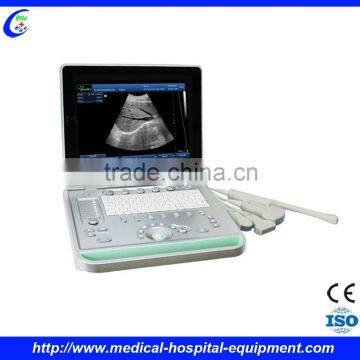 3d Ultrasound Machine