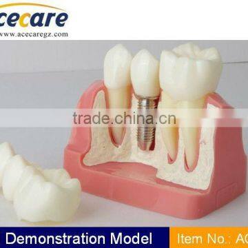 high quality dental teaching model