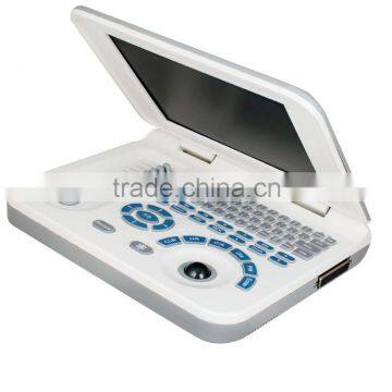 Hot Sale Sony Printer /medical Use Ultrasonic Diagnostic-Large Screen 10.4 Inch Laptop Ultrasound Scanner photo-4