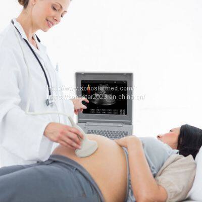 SS-6B Laptop All-Digital Ultrasound photo-5