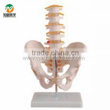 BIX-A1022 life-size pelvis model with 5 lumbar vertebra model