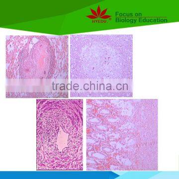 Individual slides you can choose from High Quality Human Pathological Histology Prepared Microscope Slides