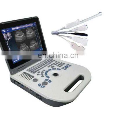 best price  scanner  handheld medical portable 12 inch LED laptop black and white ultrasound