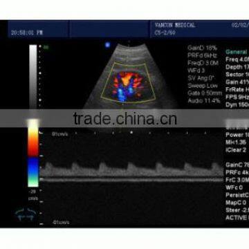 MSLCU01 Best Seller Portable Color Doppler Ultrasound in China