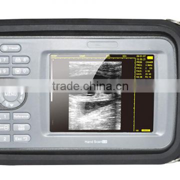 5.5 inch TFT color LCD monitor Hand held Ultrasound Scanner HandScan H8 with CE Approved