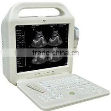 2016 LCD Display Ultrasound Scanner With Convex Probe photo-2