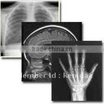 Low price digital dry imaging film, x-ray film chemical