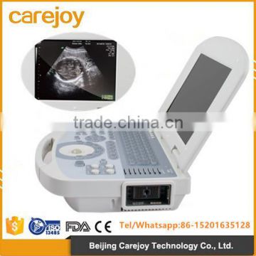 CE& FDA approved Digital Portable Ultrasound Scanner Suitable for the diagnosis of Abdomen, Cardiac, Gynecology, Obstetrics