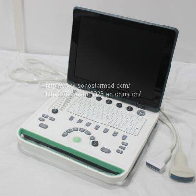 C5Pre Laptop Color Doppler photo-4