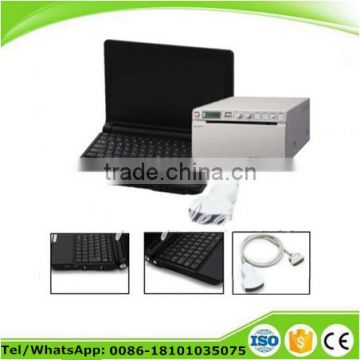 CE certified 10 inch Laptop Ultrasound machine RUS-9000F with 3.5Mhz Convex SONY UP-898MD OPTIONAL