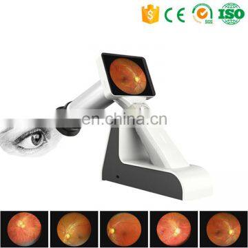 Hand Held non-mydriatic Digital Fundus Camera