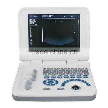 Hot Cheapest Abdominal Pregnant Diagnosis Laptop Ultrasound Scanner/Machine With Probe/Transducer-RUS-9000F2 photo-2