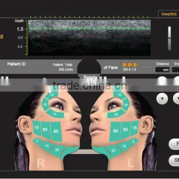 300W Hifu Body Slimming Hifu Chest Shaping Face Lift& Wrinkle Removal Machine photo-4