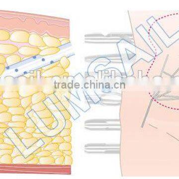 PAL Power Assisted Liposuction Machine photo-3