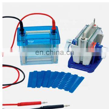 Assessment serum protein electrophoresis in clinical diagnosis