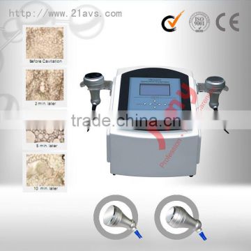 New Ultrasonic Liposuction RF Body Slimming beauty machine