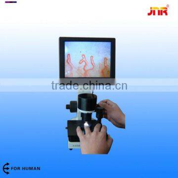 video capillary microscope capillaroscope video microcirculation microscope