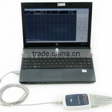 MC-8000G Laptop ECG machine price