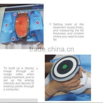 Ultrashape Beauty Slimming Machine Ultrashape Syneron photo-6