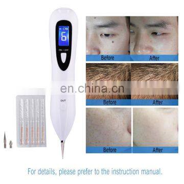 Mini Skin Tag Remover Device Portable Spider Vein Beauty Pen Mole Removal Machine for Skin Care photo-3
