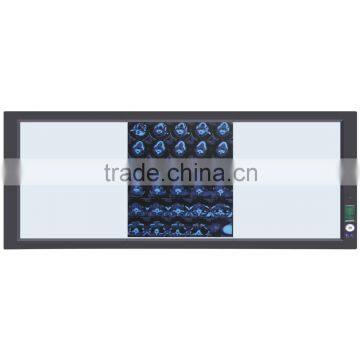 Led x Ray Medical View Box photo-3
