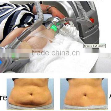 Cool tech fat freezing slimming device with 2 handpieces working same time